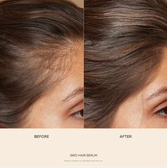 Vegamour GRO and Wash Kit - Picture 2 of 4